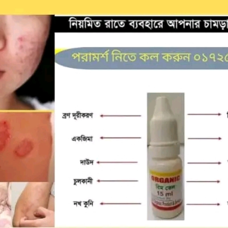 রিম ওয়েল এলার্জি একজিমা ও মুখের ব্রন কার্যকর