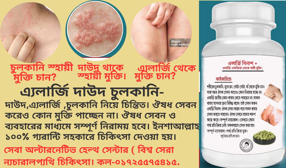 https://bdmedicineshop2.com/product/allergi-eczema